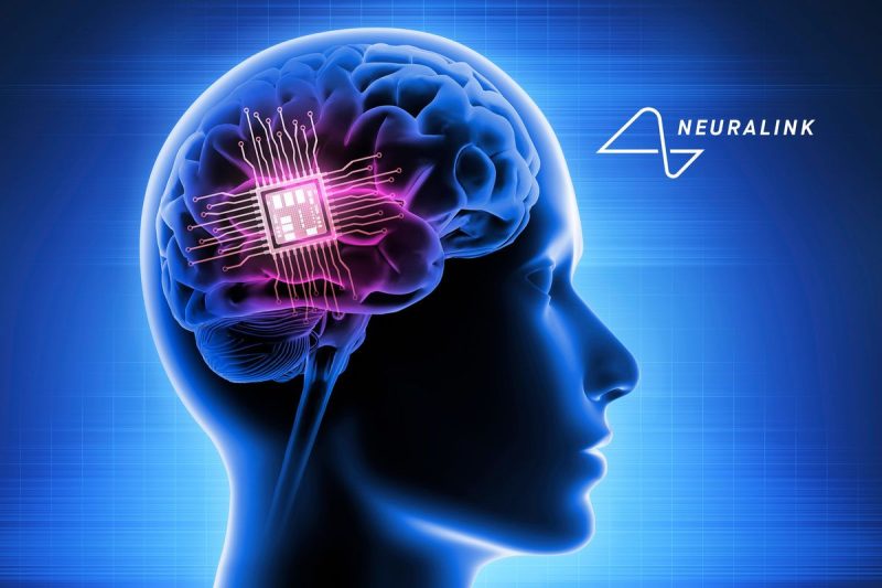  Can You Invest in Neuralink?